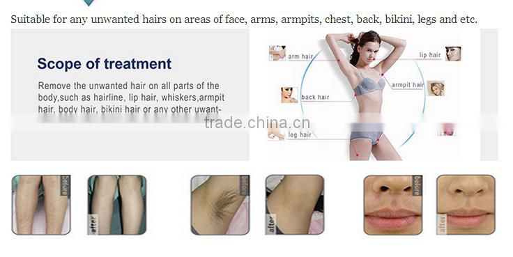 Y9D-Ydel promotion!!! perfect 808 nm diode laser hair removal machine for sale