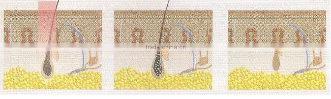 Y8A Merry Christmas 20% OFF 808nm diode laser painless hair removal machine