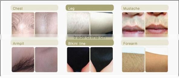 Y8B painless 808nm diode laser permanent depilation