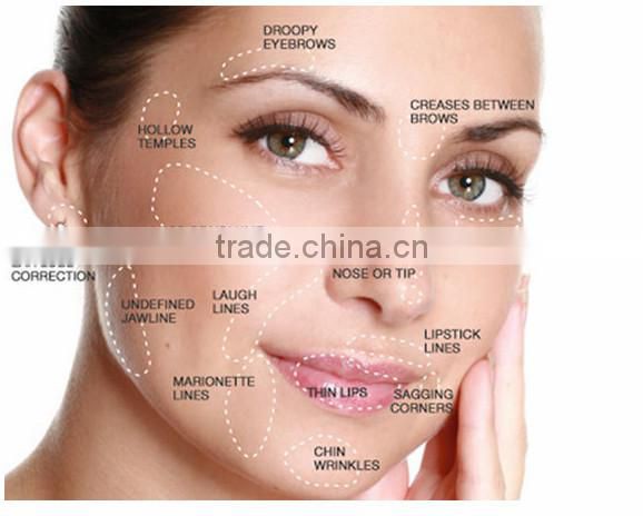China Cross-linked HA hyaluronic acid gel .Singfiller fine 0.1-0.15mm 20mg/ml Superfacial finel;Hyaluronic; HA; 9067-32-7