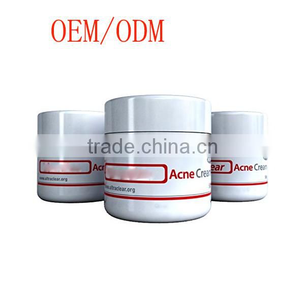 Skincare Pimples Removal Face Acne Treatment Whitening Cream