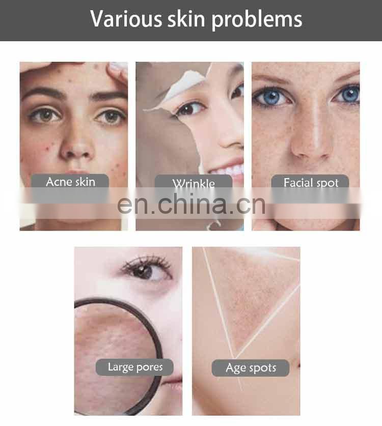 Skin rejuvenation /multifunctional plasma pen / beauty device