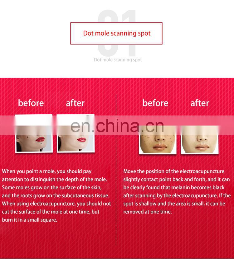 2019  Beauty Monster Plasma Pen for Spot Mole