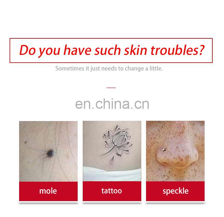 2019  Beauty Monster Plasma Pen for Spot Mole