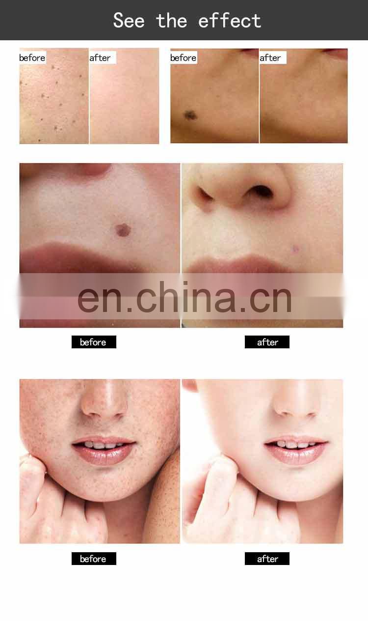 Skin rejuvenation /multifunctional plasma pen / beauty device