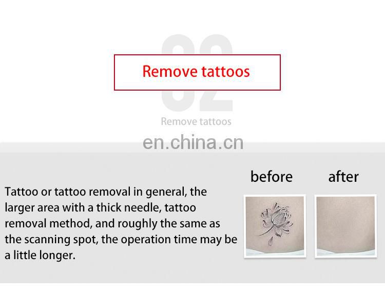 2019  Beauty Monster Plasma Pen for Spot Mole