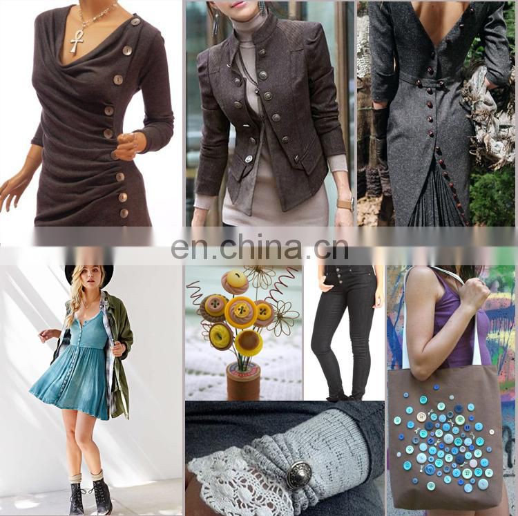 china supplier mental fashion button;mental fashion button china supplier;china supplier fashion mental button