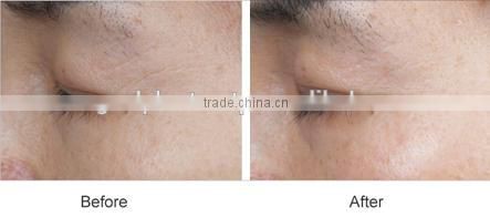 Skin Rejuvenating SR Serum