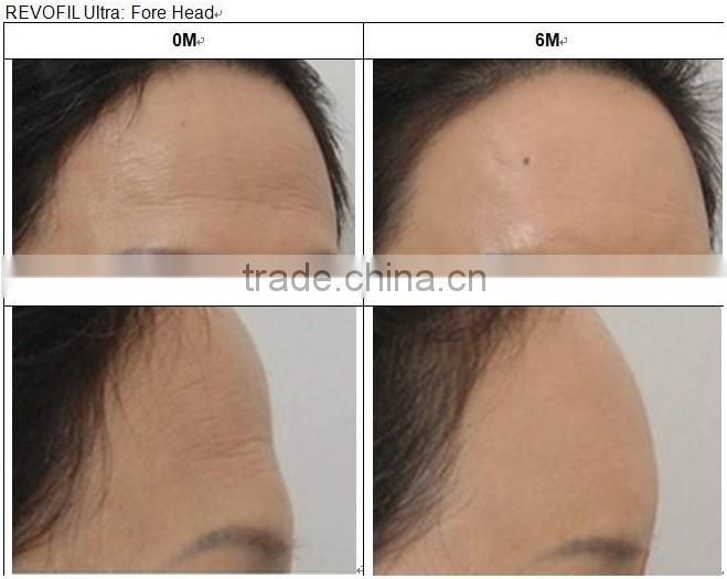 Stay Longer Derma - Ultra Face Serum