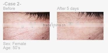 NEW ARRIVAL!! Eye Filler Mask