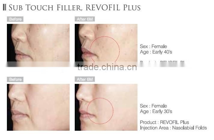 Anti-Aging Face Serum FINE