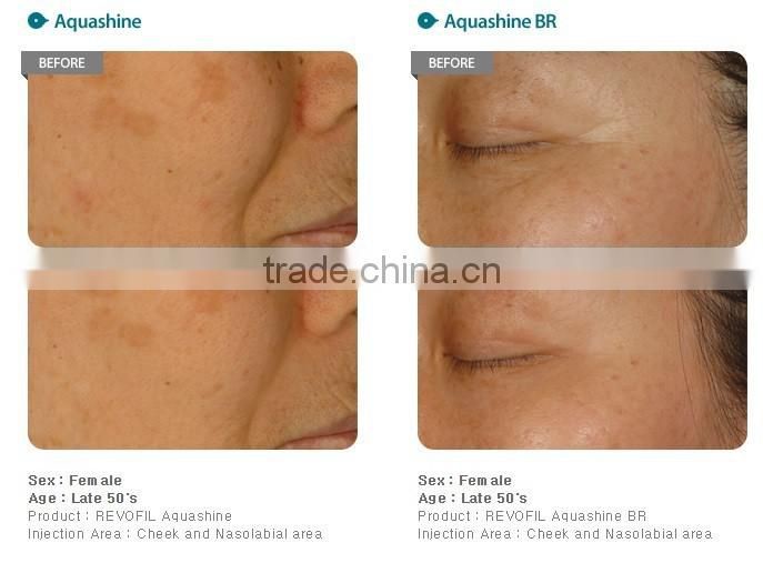 ANTI-AGING Face Serum Aquashine