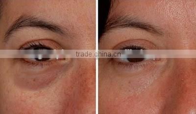 Fast Result Meso Therapy Eyebag Solution