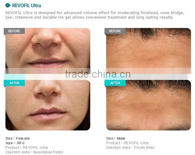 Stay Longer Derma - Ultra Face Serum