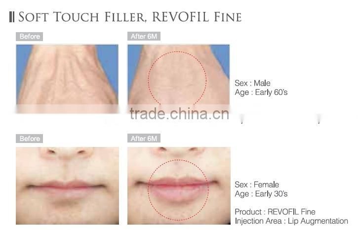 Anti-Aging Face Serum FINE