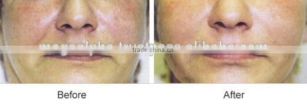 Skin Rejuvenating SR Serum